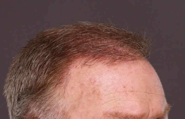 After Image