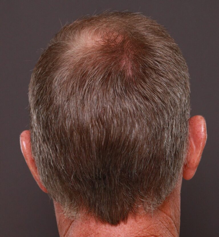After Image