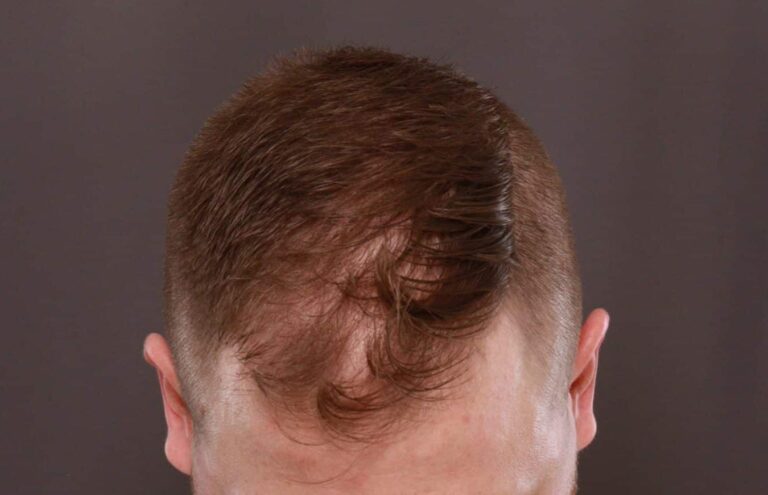 Before Image