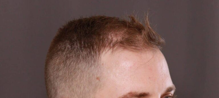 Before Image