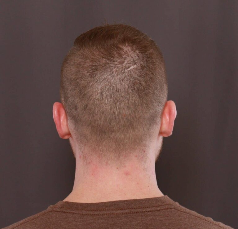 Before Image