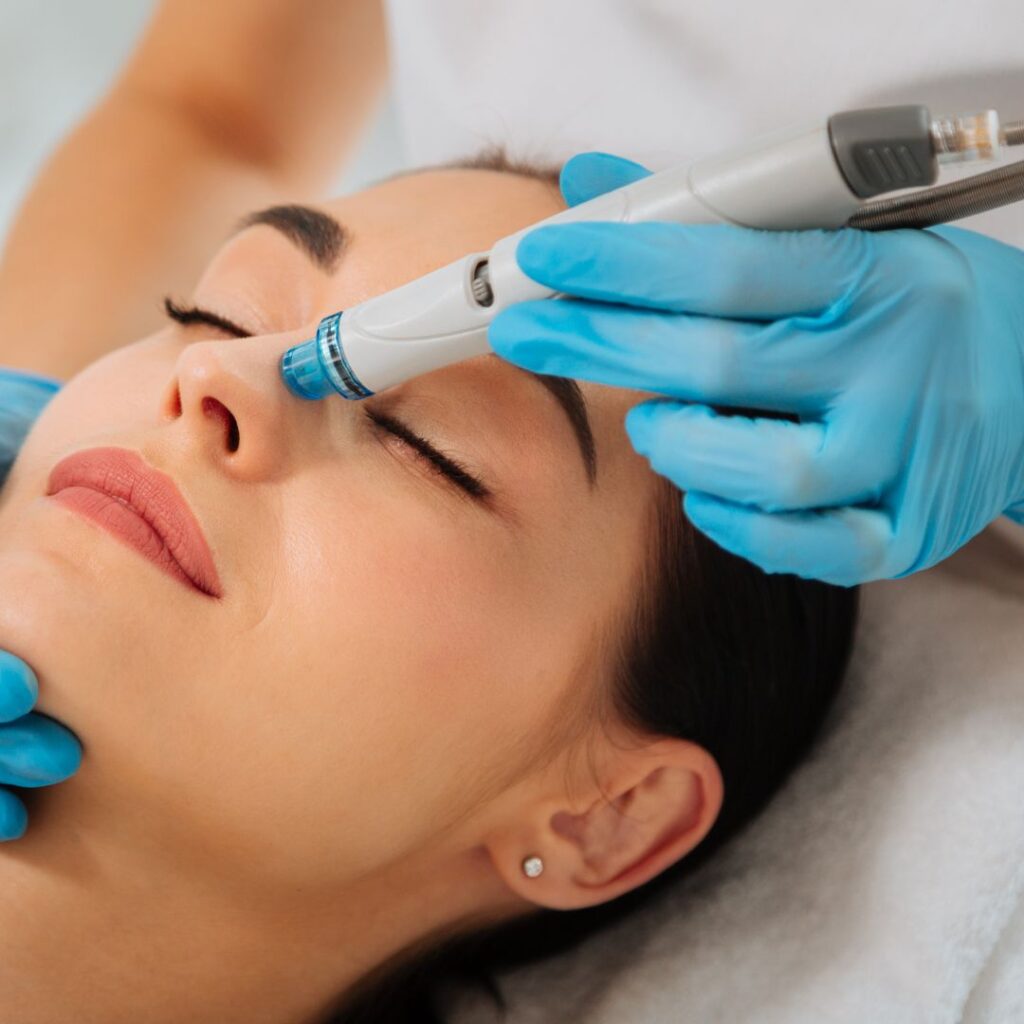 wedding hydrafacial