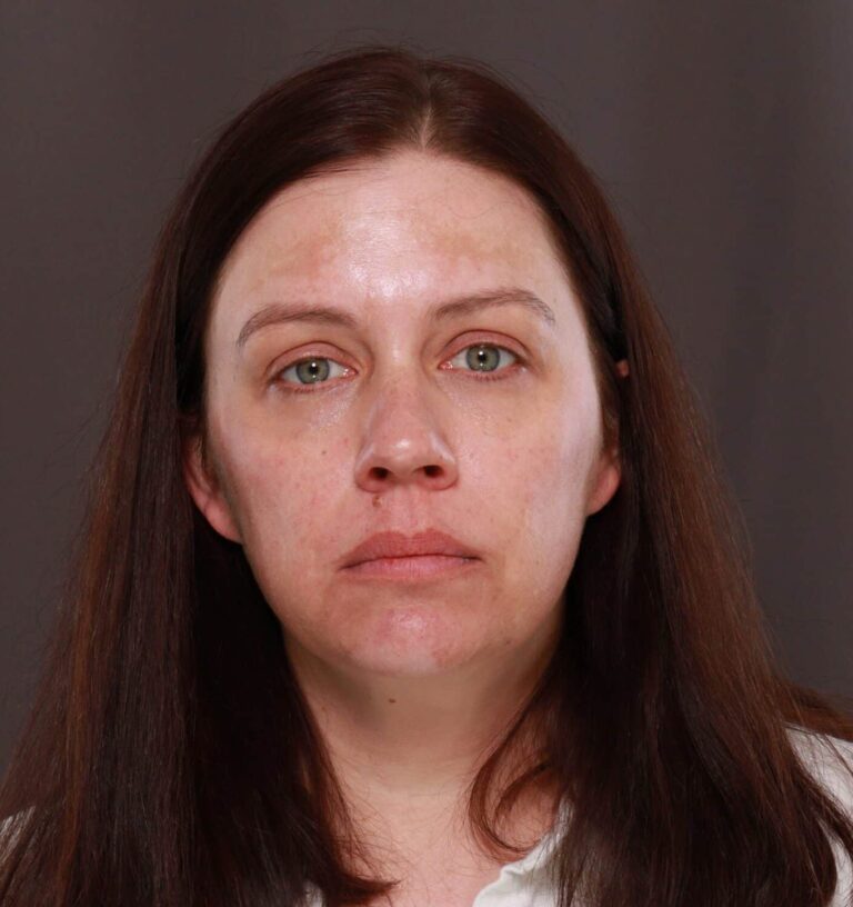 Before Image: Halo & Moxi STaX Treatment - front