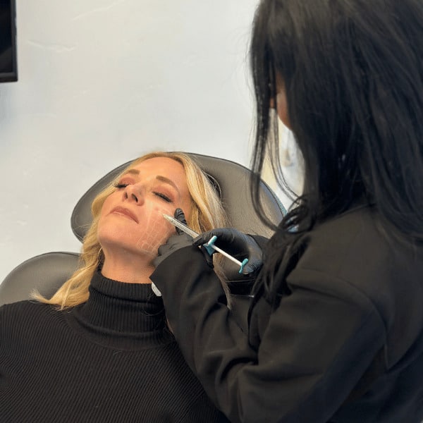 SKINVIVE Juvederm Salt Lake City UT