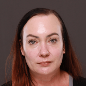 Moxi & BBL Skin Resurfacing