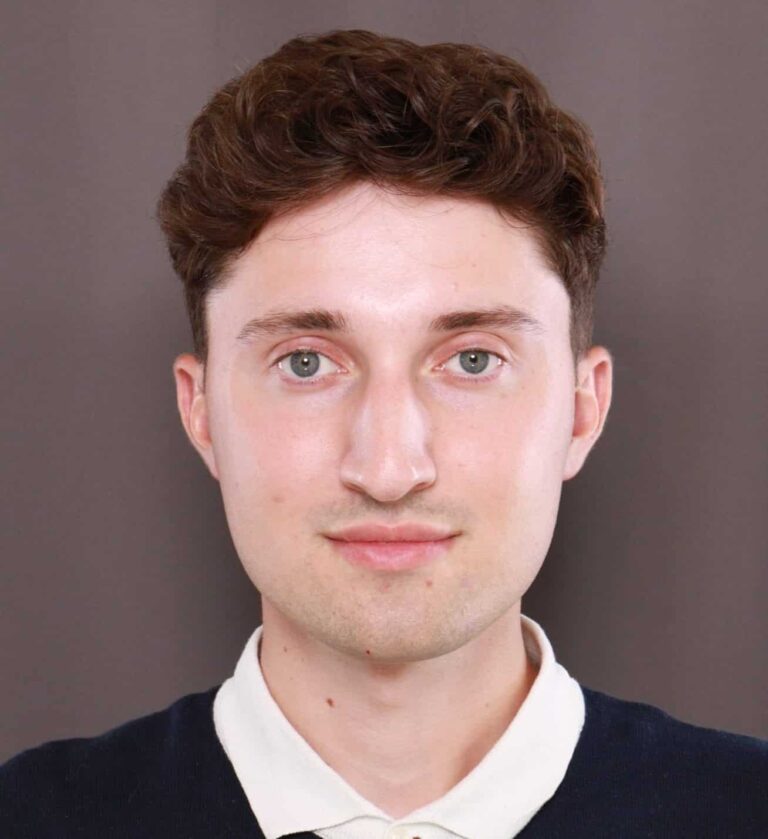 Before Image: Rhinoplasty by Dr. Henstrom - front