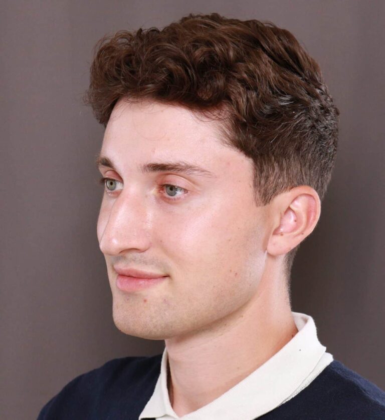 Before Image: Rhinoplasty by Dr. Henstrom - left-front-oblique