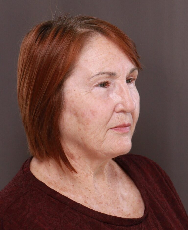 Before Image: Contour TRL by Katy Larson - right-front-oblique