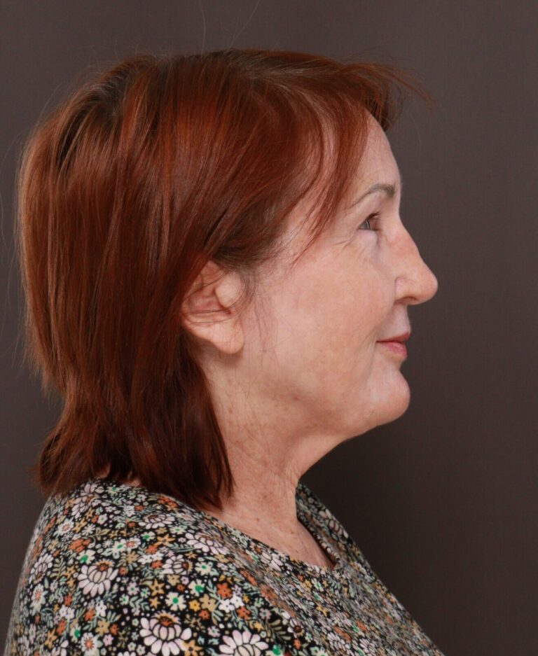 After Image: Contour TRL by Katy Larson - right-side