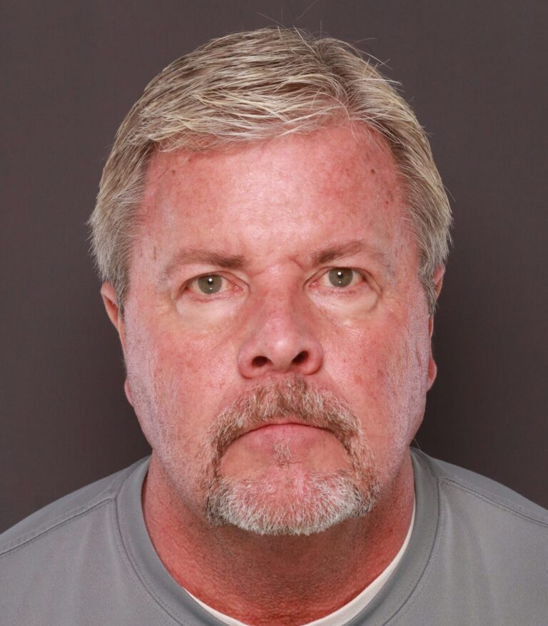 Before Image: Upper & Lower Blepharoplasty with Fat Repositioning by Dr. Henstrom - front