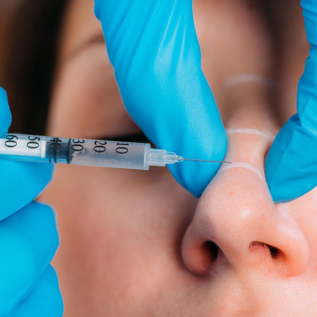 Make Your Nose Fit Your Face Surgical and NonSurgical Options Utah