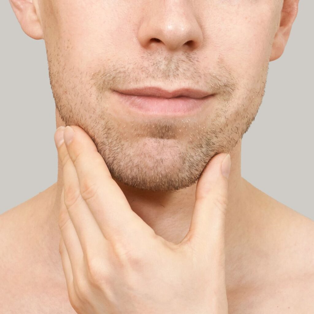 chin implant recovery