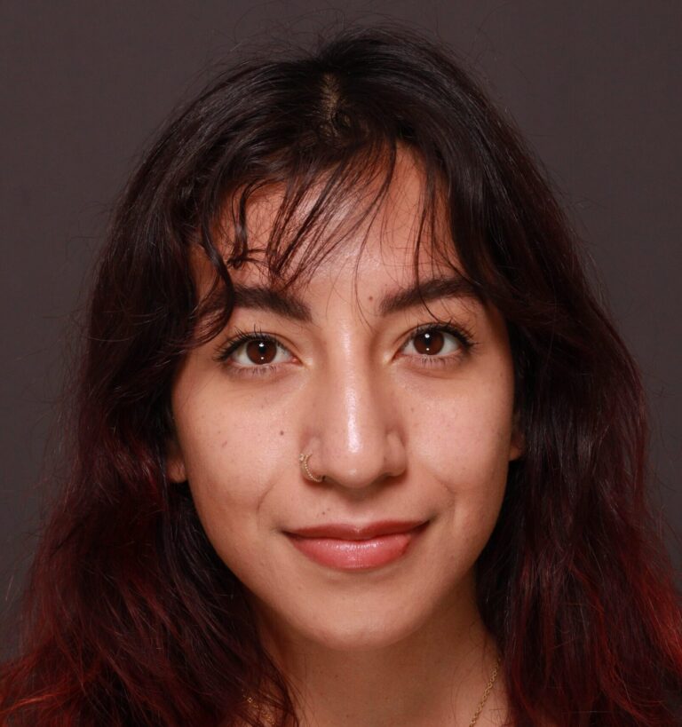 Before Image: Rhinoplasty by Dr. Manning - front