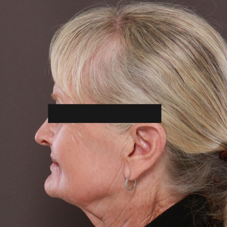 After Image: Contour TRL with Katy Larson - left-side