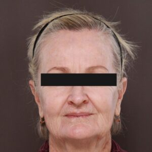 Before Image: Contour TRL with Katy Larson