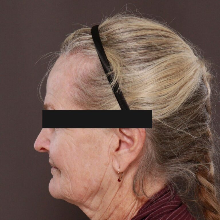 Before Image: Contour TRL with Katy Larson - left-side