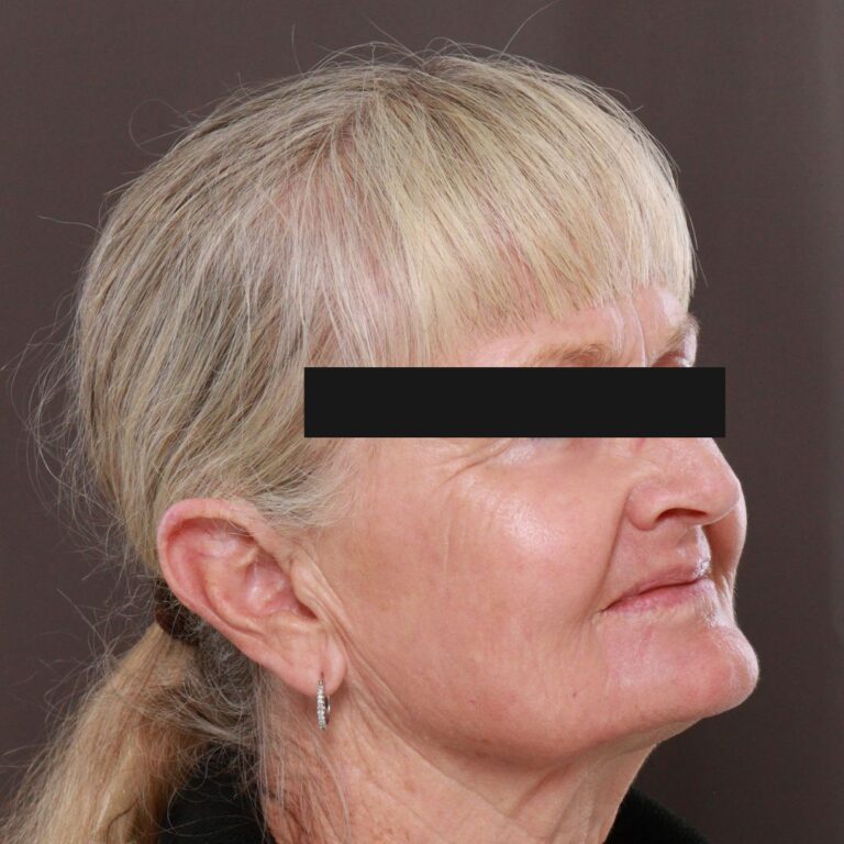 After Image: Contour TRL with Katy Larson - right-front-oblique