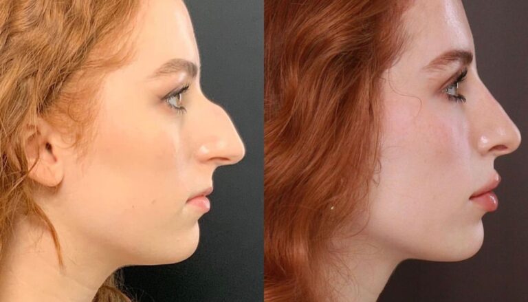 Noelle b&A
