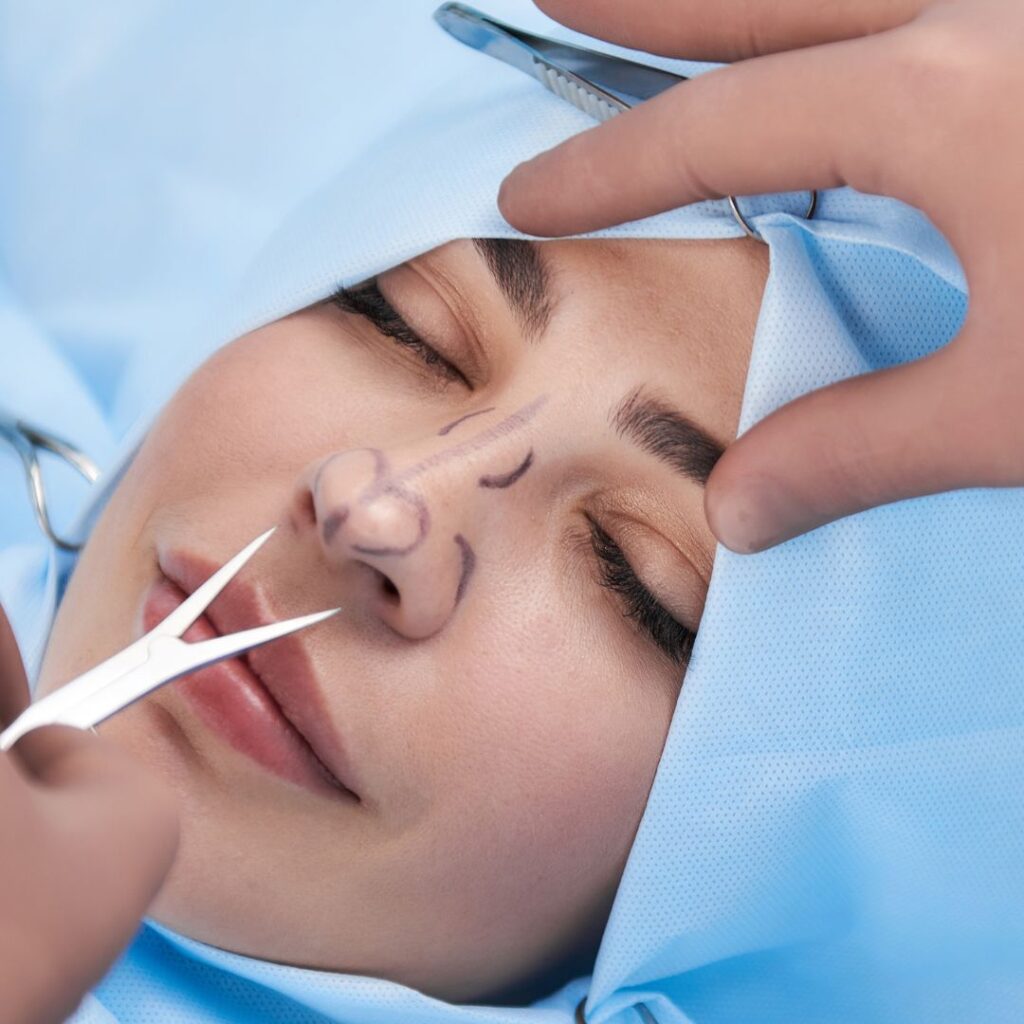 Rhinoplasty
