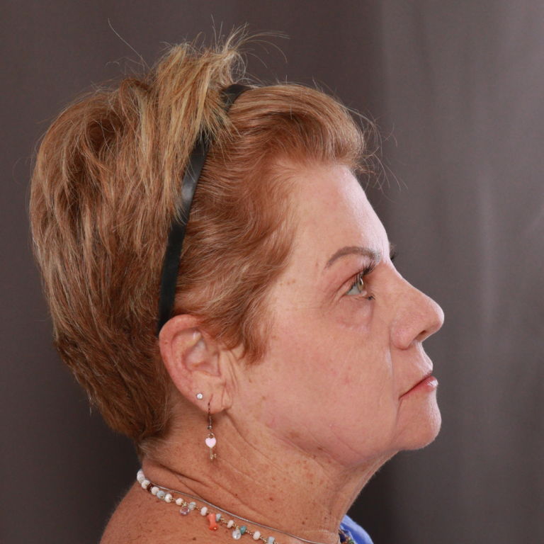 After Image: Contour TRL by Katy Larson - right-side