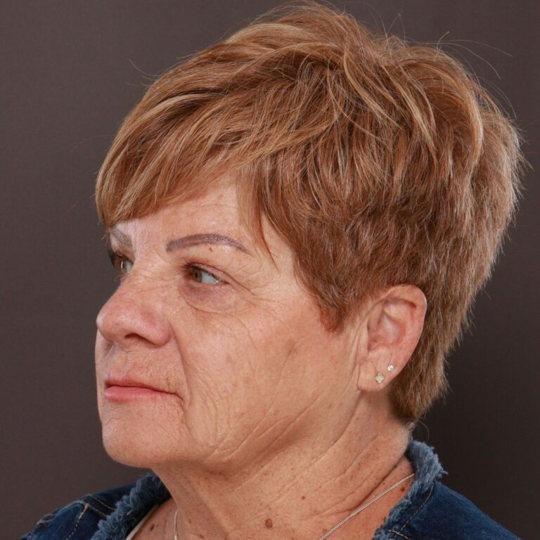 Before Image: Contour TRL by Katy Larson - left-front-oblique