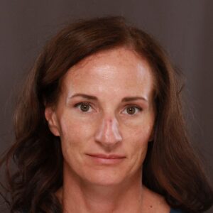 Before Image: Halo and BBL by Katy Larson