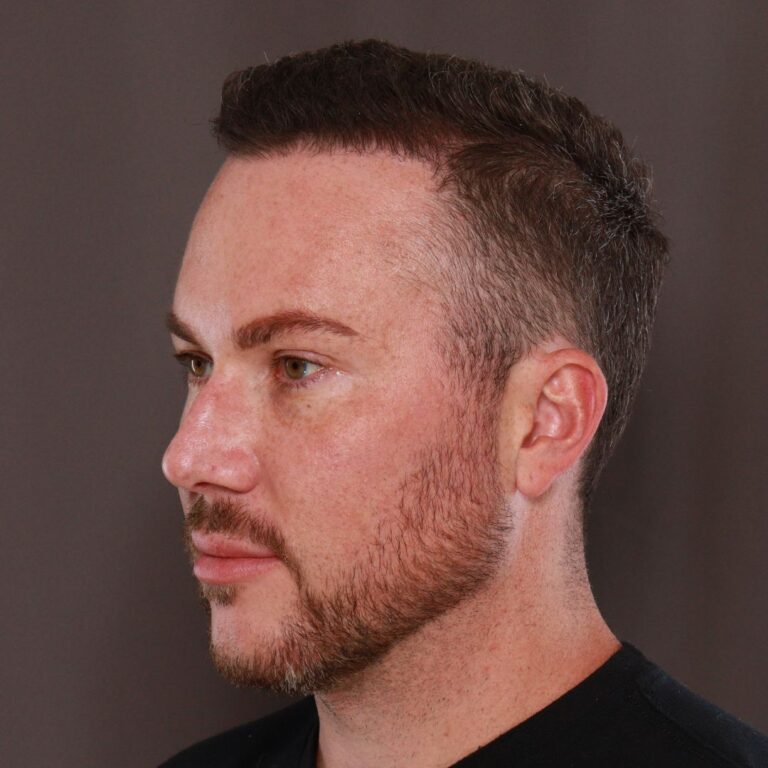 Before Image: Moxi & Sylfirm X - left-front-oblique