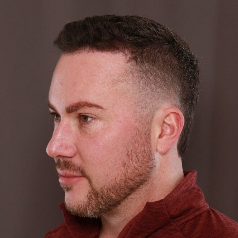 After Image: Moxi & Sylfirm X - left-front-oblique