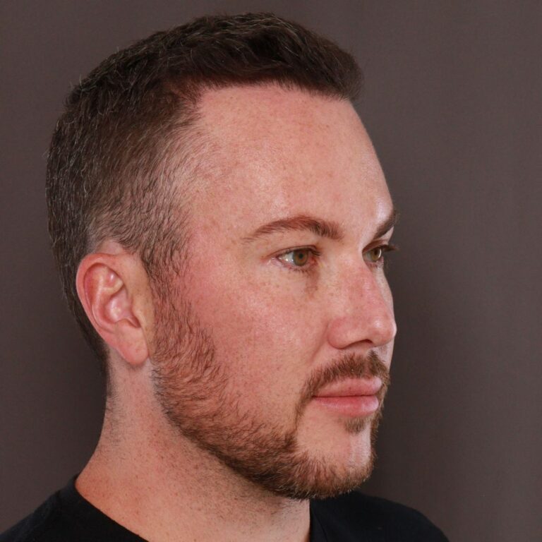 Before Image: Moxi & Sylfirm X - front