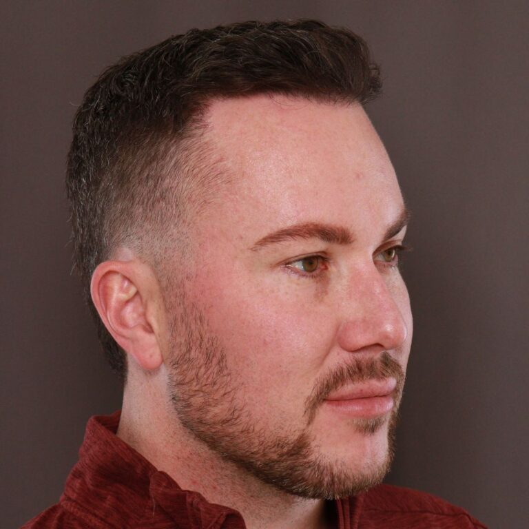 After Image: Moxi & Sylfirm X - front