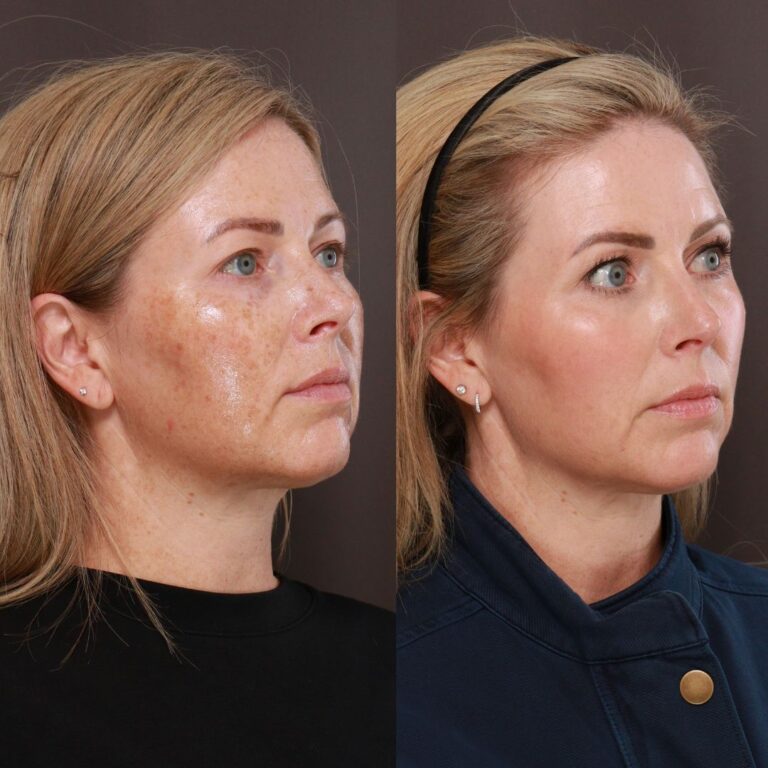 Moxi and BBL 768x768