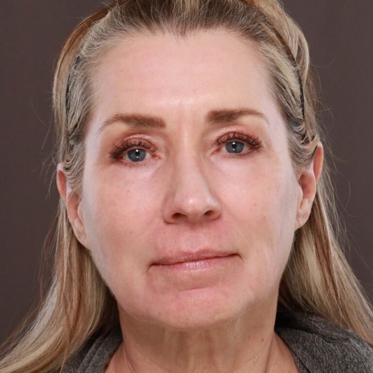 After Image: Contour TRL by Katy Larson - front