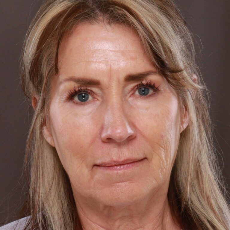 Before Image: Contour TRL by Katy Larson - front