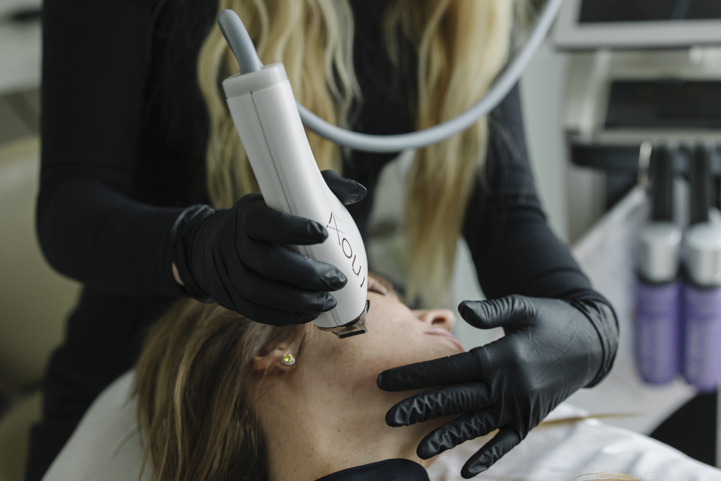 Moxi Treatment Utah Facial Plastics