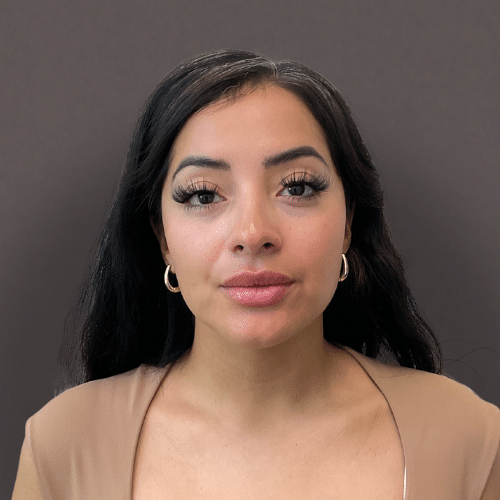 Before Image: Corrected Lip Filler - front