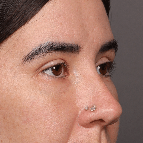 After Image: Post #140466 - right-front-oblique