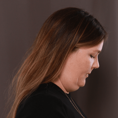 Before Image: Lower Face Contouring - right-side