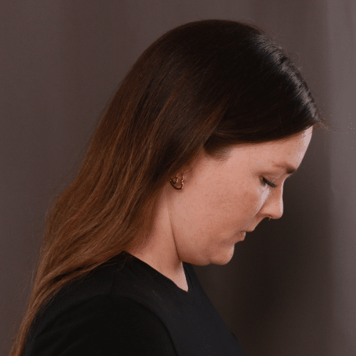 After Image: Lower Face Contouring - right-side