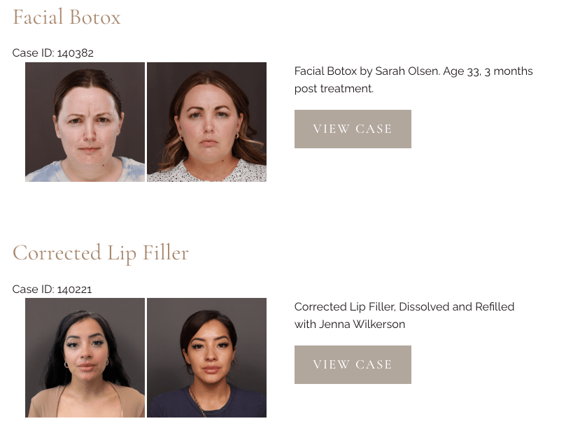 Before & After Gallery at Utah Facial Plastics 