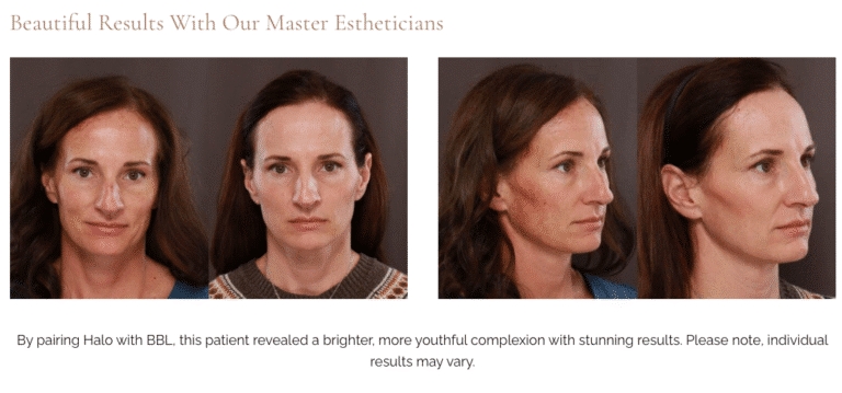 Utah Facial Plastics