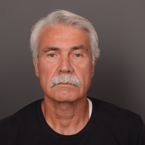After Image: Brow Lift by Dr. Henstrom - front