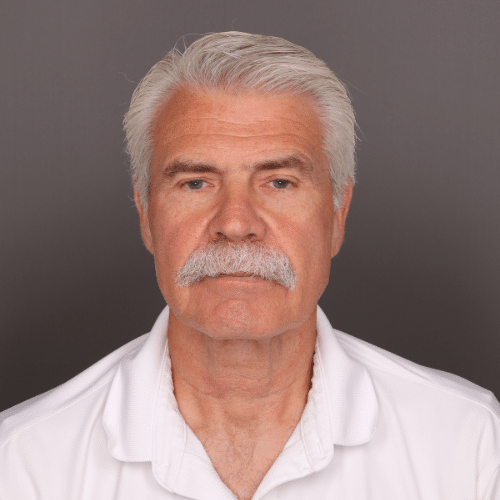 Before Image: Brow Lift by Dr. Henstrom - front