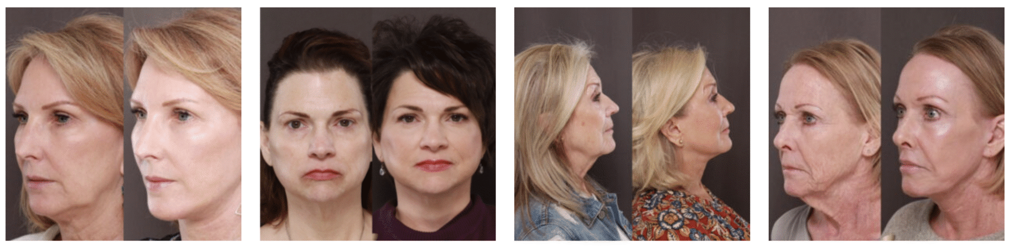 Utah Facial Plastics