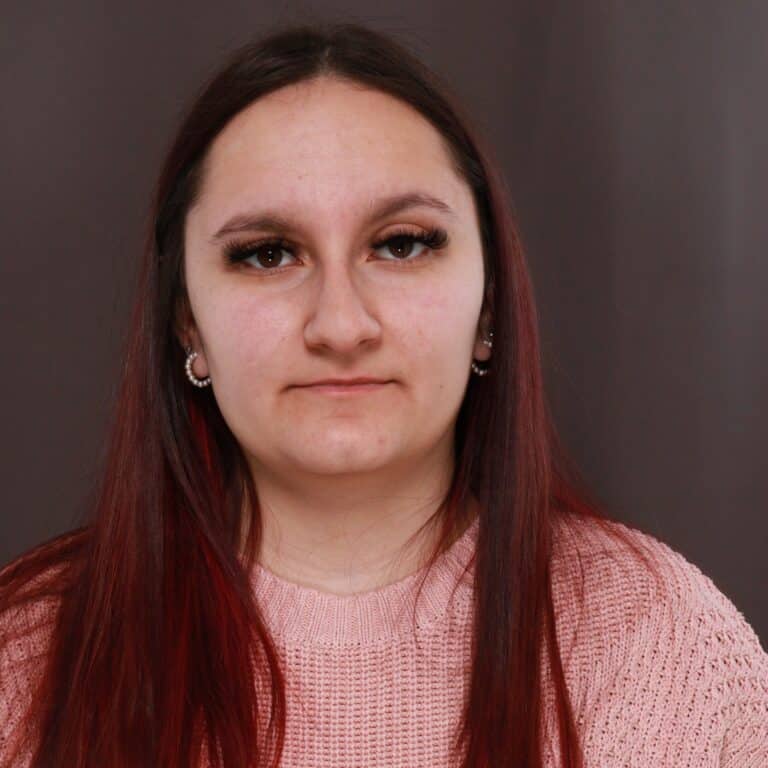 Before Image: Rhinoplasty with Weirs - front