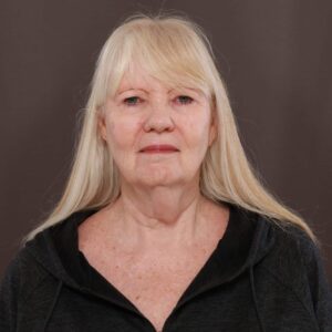 Before Image: Direct Necklift