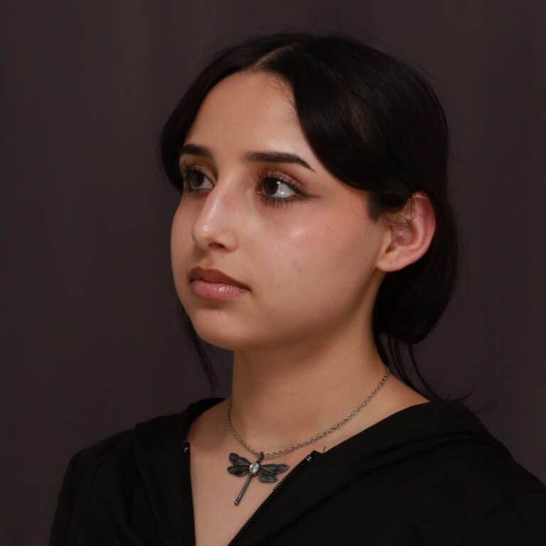 Before Image: Rhinoplasty - 