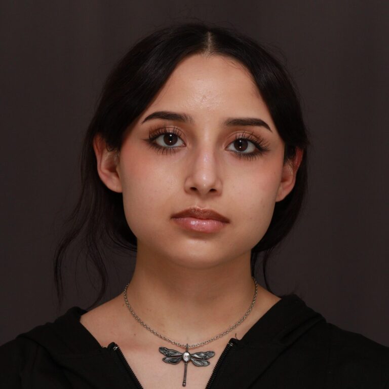 Before Image: Rhinoplasty - front