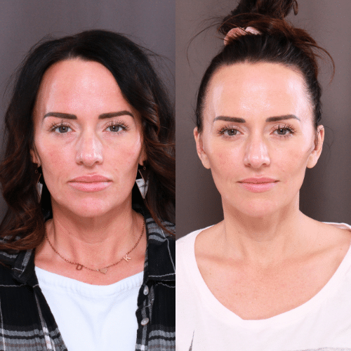 24779 Sylfirm X Treatments (2) 24779 Sylfirm X Treatments (2)