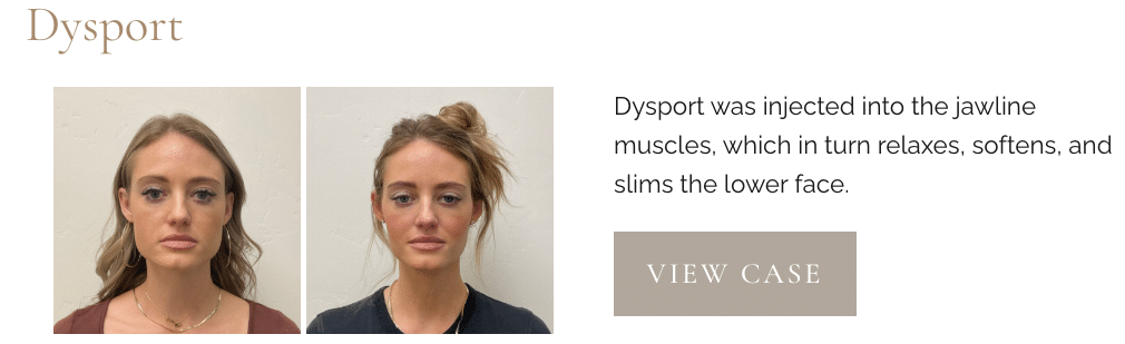 Botox at Utah Facial Plastics