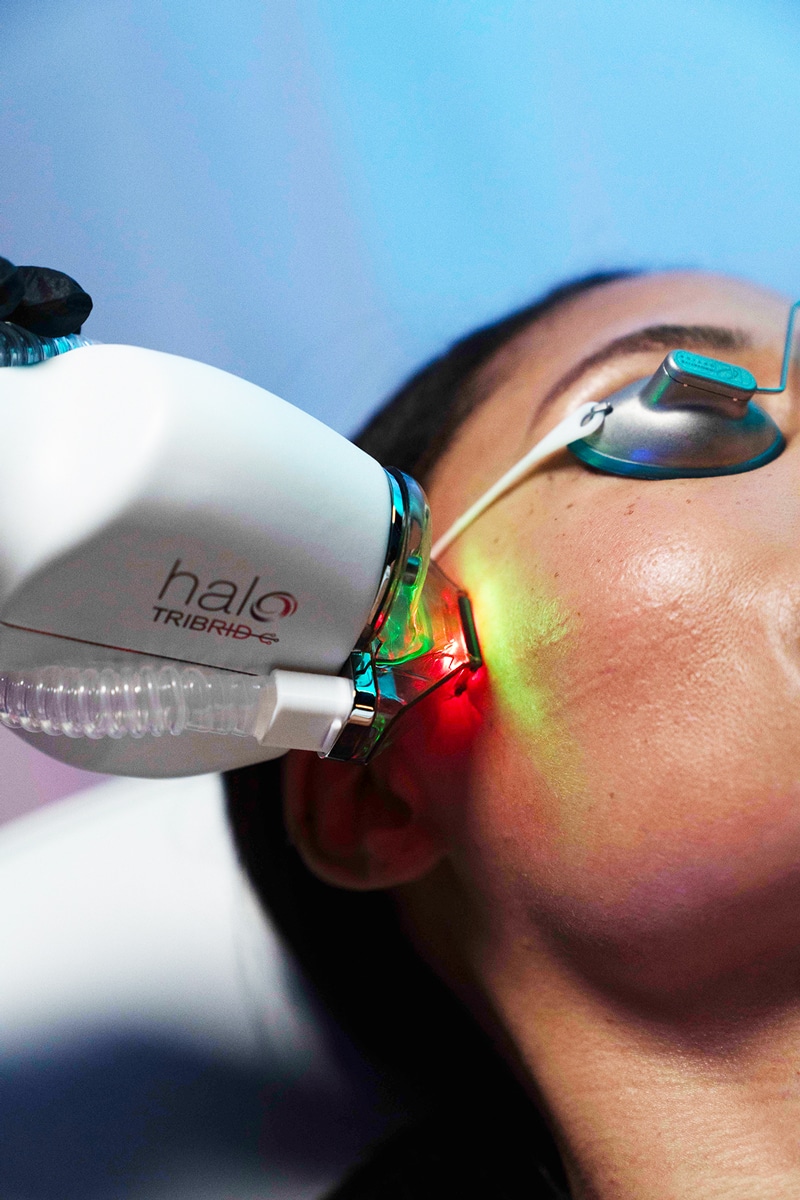 Halo Tribrid Fractional Laser Treatment